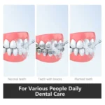 ⁦جهاز تنظيف الأسنان المائي H2ofloss HF-6 لاسلكي قابل لإعادة الشحن⁩ - الصورة ⁦13⁩