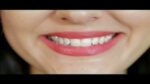 ⁦طقم أسنان علوي Perfect Smile قابل للإزالة – ابتسامة فورية بشكل طبيعي⁩ - الصورة ⁦5⁩